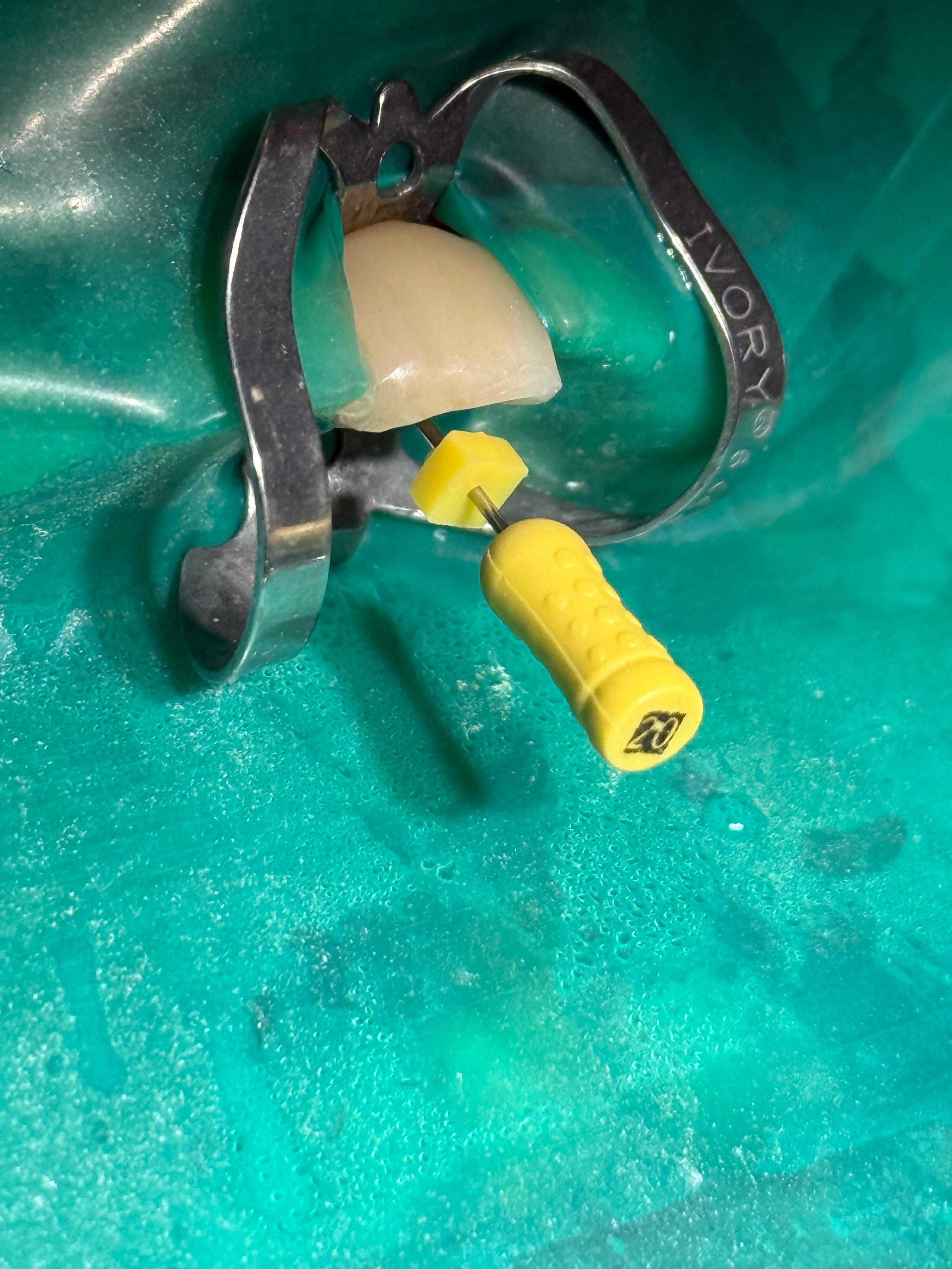 Endodonzia