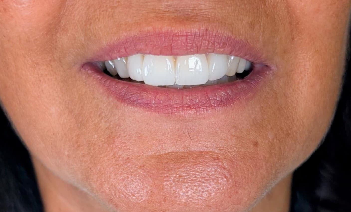 Estetica Dentaria